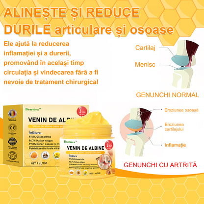 🌟🐝𝐁𝐞𝐚𝐫𝐧𝐢𝐜𝐚™ 𝐂𝐫𝐞𝐦ă 𝐀𝐯𝐚𝐧𝐬𝐚𝐭ă 𝐜𝐮 𝐕𝐞𝐧𝐢𝐧 𝐝𝐞 𝐀𝐥𝐛𝐢𝐧𝐞 𝐩𝐞𝐧𝐭𝐫𝐮 𝐀𝐫𝐭𝐢𝐜𝐮𝐥𝐚ț𝐢𝐢 ș𝐢 𝐎𝐚𝐬𝐞 (𝐄𝐱𝐭𝐫𝐚𝐜𝐭 𝐝𝐞 𝐕𝐞𝐧𝐢𝐧 𝐝𝐞 𝐀𝐥𝐢𝐧𝐞 𝐝𝐢𝐧 𝐍𝐨𝐮𝐚 𝐙𝐞𝐚𝐥𝐚𝐧𝐝𝐚 - 𝐒𝐩𝐞𝐜𝐢𝐚𝐥𝐢𝐳𝐚𝐭 𝐢𝐧 𝐃𝐢𝐬𝐞𝐚𝐬𝐞 𝐎𝐫𝐭𝐨𝐩𝐞𝐃𝐢𝐜𝐞 𝐬𝐢 𝐏𝐚𝐢𝐧𝐞 𝐝𝐢𝐧 𝐀𝐫𝐭𝐫𝐢𝐭𝐚