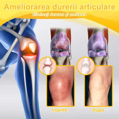 🌿🐝🌿BEARNICA™ Cremă Avansată pentru Îngrijirea Articulațiilor și Osoasă cu Venin de Albină🔥 (Ultima zi de promoție, 20% reducere)